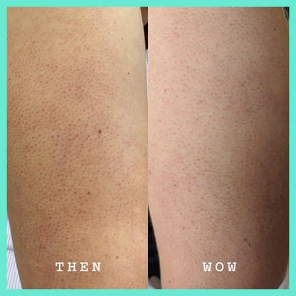 Glycolic Body Srub -250G