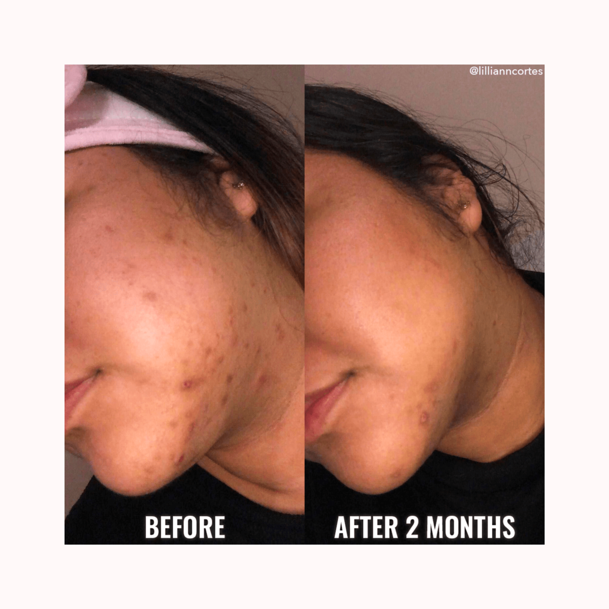 DISCOLORATION CORRECTING SERUM