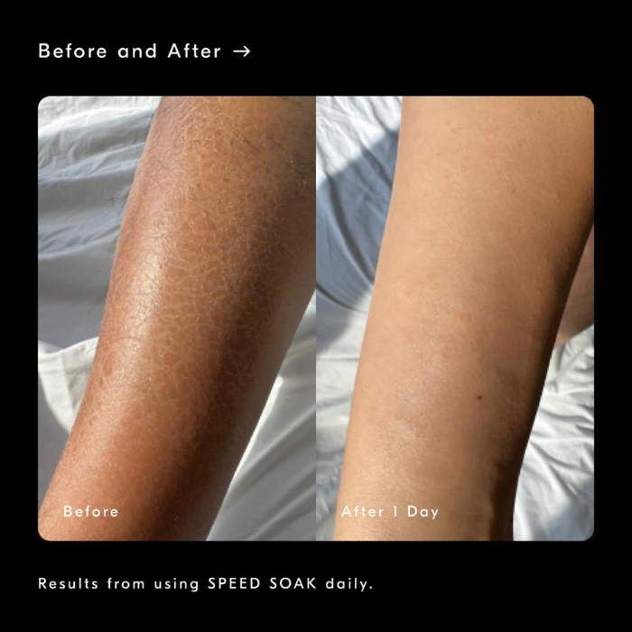 Speed Soak Fast-Absorbing + Hydrating Body Gel Moisturizer