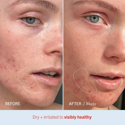 First Aid Beauty Ultra Repair® Cream Intense Hydration