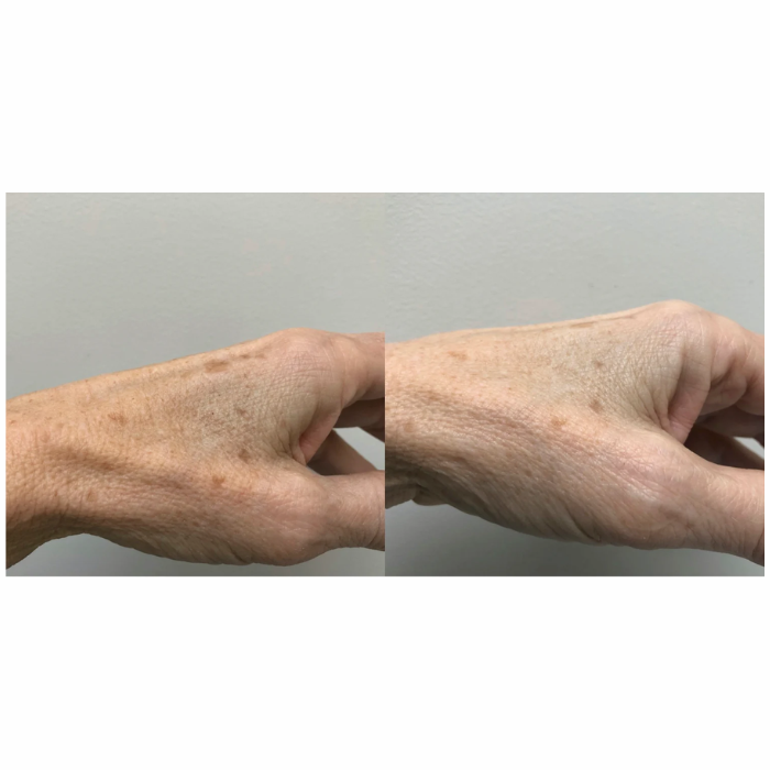 Renewing Hand Serum