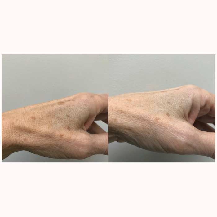 Renewing Hand Serum