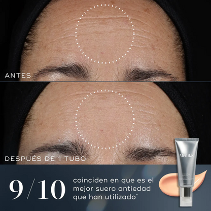 Crystal Retinal 3