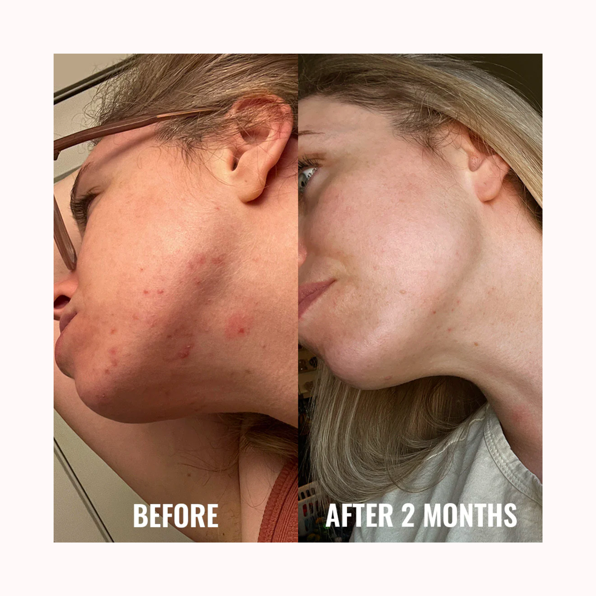 DISCOLORATION CORRECTING SERUM